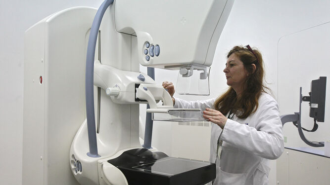 Mamógrafo en el que se realizan las pruebas en el CARE Bola Azul de la capital almeriense.