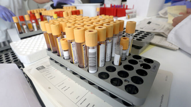 Investigadores de la UAL mejoran los tratamientos de la anemia