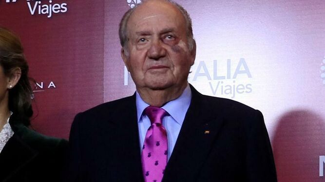 Don Juan Carlos, en Las Ventas hace unos días con un ojo morado.
