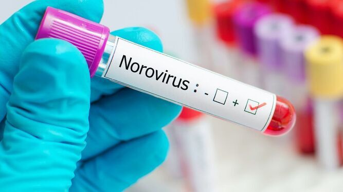 Muestra de norovirus como el causante del brote en Mojácar.